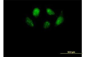 Immunofluorescence of purified MaxPab antibody to SMU1 on HeLa cell. (SMU1 Antikörper  (AA 1-513))