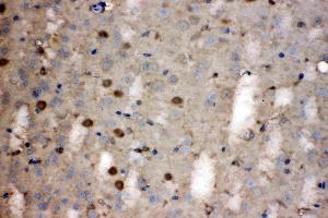 LDHB was detected in paraffin-embedded sections of mouse brain tissues using rabbit anti- LDHB Antigen Affinity purified polyclonal antibody (Catalog # ) at 1 µg/mL. (LDHB Antikörper  (AA 237-334))