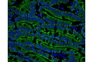 human duodenum (courtesy of L.