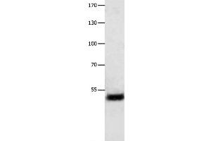 Western Blot analysis of Human liver cancer tissue using EEF1 gamma Polyclonal Antibody at dilution of 1:800