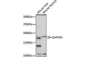 Western blot analysis of extracts of various cell lines, using G antibody (ABIN7267529) at 1:1000 dilution. (GAPVD1 Antikörper  (AA 1-260))