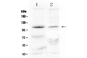 Western blot analysis of HIF2A using anti- HIF2A antibody .