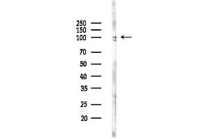 anti-E2F Transcription Factor 8 (E2F8) (C-Term) antibody