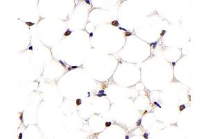 Immunohistochemistry analysis of paraffin-embedded mouse adipose tissue using PPARG Monoclonal Antibody at dilution of 1:1000. (PPARG Antikörper)