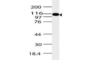 Image no. 1 for anti-ArfGAP with SH3 Domain, Ankyrin Repeat and PH Domain 2 (ASAP2) (AA 500-760) antibody (ABIN5027044) (ASAP2 Antikörper  (AA 500-760))