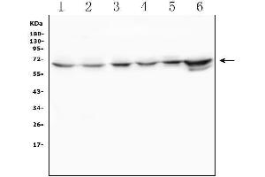 Western blot analysis of TDRD3 using anti-TDRD3 antibody (ABIN6719636). (TDRD3 Antikörper)