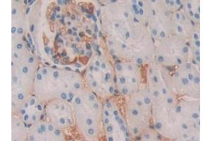 Immunohistochemistry (IHC) image for anti-serpin Peptidase Inhibitor, Clade A (Alpha-1 Antiproteinase, Antitrypsin), Member 6 (SERPINA6) (AA 267-390) antibody (ABIN7438400)