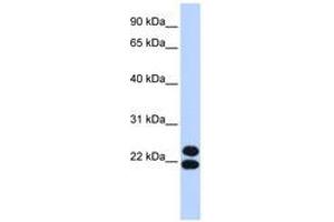 Image no. 1 for anti-Paired Related Homeobox 2 (PRRX2) (AA 35-84) antibody (ABIN6742837) (PRRX2 Antikörper  (AA 35-84))