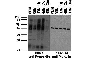 Immunoblot against crude membrane fractions from whole mouse (MBM) or rat (RBM) brain and from human hippocampus [HBM(H)], cerebral cortex [HBM(Cx)] or cerebellum [HBM(Cb)] and probed with K96/7 (left) or N52A/42 (right) TC supe. (Olfactomedin 1 Antikörper  (pan))