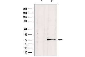 Western blot analysis of extracts from HepG2, using NUDT21 antibody.