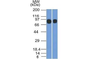 Western Blotting (WB) image for anti-Membrane Metallo-Endopeptidase (MME) (AA 297-483) antibody (ABIN6940060)