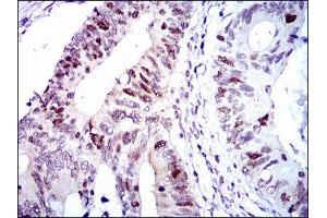 Immunohistochemistry (IHC) image for anti-Cyclin-Dependent Kinase 2 (CDK2) antibody (ABIN1845617) (CDK2 Antikörper)