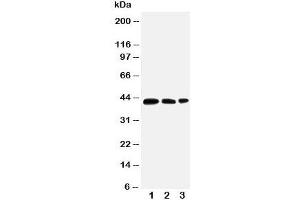 Western blot testing of AQP2 antibody and Lane 1:  MCF-7;  2: SW620;  3: HT1080 cell lysate.