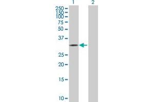 Western Blot analysis of CDK10 expression in transfected 293T cell line by CDK10 MaxPab polyclonal antibody. (CDK10 Antikörper  (AA 1-331))