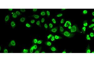 Immunofluorescence analysis of A-549 cells using FIP1L1 Polyclonal Antibody