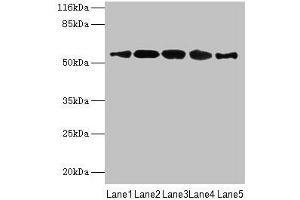 Western blot All lanes: VIPAS39 antibody at 12 μg/mL Lane 1: HepG2 whole cell lysate Lane 2: A431 whole cell lysate Lane 3: 293T whole cell lysate Lane 4: Mouse kidney tissue Lane 5: Hela whole cell lysate Secondary Goat polyclonal to rabbit IgG at 1/10000 dilution Predicted band size: 58, 52 kDa Observed band size: 58 kDa (VIPAR Antikörper  (AA 1-493))