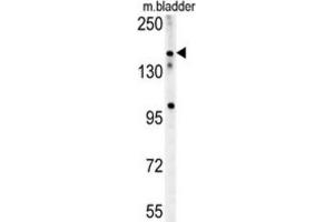 Western Blotting (WB) image for anti-Castor Zinc Finger 1 (CASZ1) antibody (ABIN2995579)