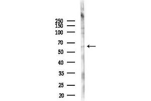 anti-Sequestosome 1 (SQSTM1) (C-Term) antibody