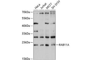 Western blot analysis of extracts of various cell lines, using RA antibody (ABIN3021607, ABIN3021608, ABIN3021609 and ABIN6215361) at 1:1000 dilution. (RAB11A Antikörper  (AA 1-216))