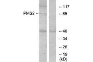 Western blot analysis of extracts from HeLa cells, using PMS2 Antibody. (PMS2 Antikörper  (AA 461-510))