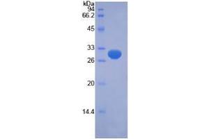 SDS-PAGE analysis of Human PINK1 Protein.