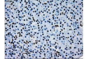 Immunohistochemical staining of paraffin-embedded lung tissue using anti-ERCC1 mouse monoclonal antibody. (ERCC1 Antikörper)