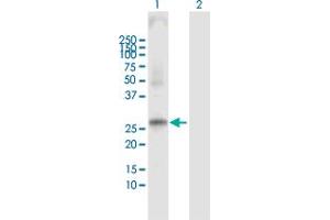 Western Blot analysis of PRSS1 expression in transfected 293T cell line by PRSS1 MaxPab polyclonal antibody. (PRSS1 Antikörper  (AA 1-247))
