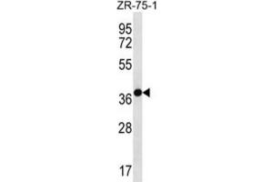 Western Blotting (WB) image for anti-Tenomodulin (TNMD) antibody (ABIN2996886) (TNMD Antikörper)