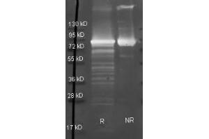 Goat anti Maltose Phosphorylase antibody  was used to detect Maltose Phosphorylase under reducing (R) and non-reducing (NR) conditions. (Maltose Phosphorylase Antikörper  (HRP))