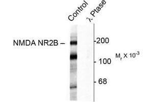 Image no. 1 for anti-Glutamate Receptor, Ionotropic, N-Methyl D-Aspartate 2B (GRIN2B) (pTyr1472) antibody (ABIN372687) (GRIN2B Antikörper  (pTyr1472))