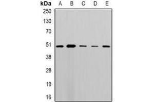 Western blot analysis of MLN64 expression in MCF7 (A), A549 (B), mouse lung (C), mouse heart (D), rat brain (E) whole cell lysates.