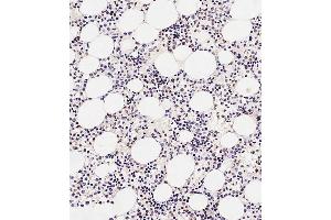 Immunohistochemical analysis of paraffin-embedded Human marrow tissue using A performed on the Leica® BOND RXm.