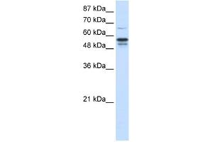 WB Suggested Anti-FOXG1B Antibody Titration:  1. (FOXG1 Antikörper  (N-Term))
