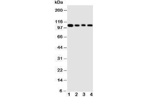 Western blot testing of HSP105 antibody and Lane 1:  rat ovary ;  2: A549 cell  lysate;  3: U87 cell  lysate;  4: HeLa cell  lysate (HSPH1 Antikörper  (AA 713-733))