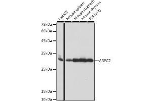 Western blot analysis of extracts of various cell lines, using  antibody (ABIN7265385) at 1:1000 dilution. (ARPC2 Antikörper)