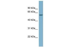 PPP5C antibody used at 1 ug/ml to detect target protein. (PP5 Antikörper  (N-Term))
