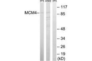 Western blot analysis of extracts from NIH-3T3/K562 cells, using MCM4 (Ab-54) Antibody. (MCM4 Antikörper  (AA 20-69))