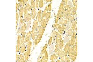 Immunohistochemistry of paraffin-embedded rat heart using CA3 antibody at dilution of 1:100 (x400 lens).