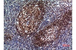 Immunohistochemistry (IHC) analysis of paraffin-embedded Human Tonsil, antibody was diluted at 1:100.
