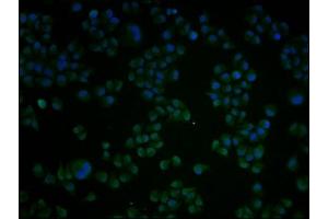 Immunofluorescence staining of Hela cells with ABIN7148793 at 1:100, counter-stained with DAPI. (ATF4 Antikörper  (AA 20-200))