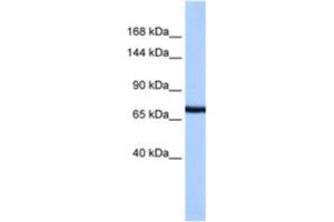 Western Blotting (WB) image for anti-Protocadherin-15 (PCDH15) antibody (ABIN2463319)