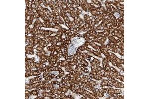 Immunohistochemical staining of human liver with TAS2R60 polyclonal antibody  shows cytoplasmic positivity in hepatocytes at 1:50-1:200 dilution. (TAS2R60 Antikörper)