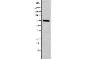Western blot analysis of HGFAC using NIH-3T3 whole cell lysates (HGFA Antikörper  (C-Term))