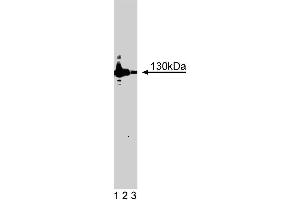 Western blot analysis of iNOS/NOS Type II on a lysate from mouse macrophages (RAW 264. (NOS2 Antikörper  (AA 961-1144))