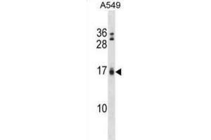 Western Blotting (WB) image for anti-BCL2-Interacting Killer (Apoptosis-Inducing) (BIK) (BH3 Domain) antibody (ABIN2997206) (BIK Antikörper  (BH3 Domain))