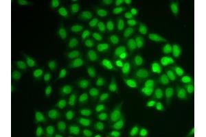 Immunofluorescence analysis of U2OS cells using UBE2V1 antibody.