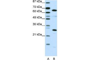 WB Suggested Anti-HMGB4 Antibody Titration:  0. (HMGB4 Antikörper  (C-Term))