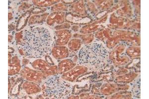 IHC-P analysis of Human Kidney Tissue, with DAB staining. (TEK Antikörper  (AA 1-116))