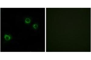 Immunofluorescence analysis of HuvEc cells, using CLDN6 Antibody. (Claudin 6 Antikörper  (AA 81-130))