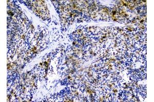 IHC analysis of CXCL12 using anti-CXCL12 antibody (ABIN6719467).